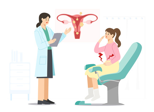 Uterine fibroids in various areas Description of the morphology of women's diseases Vector illustration