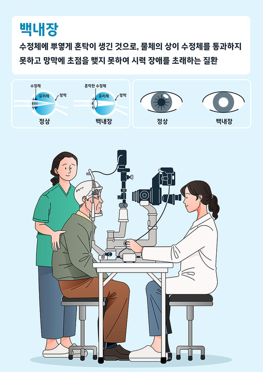 Cataract Description and Testing